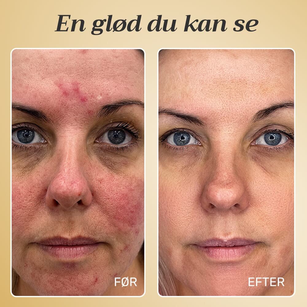 GloraMD image